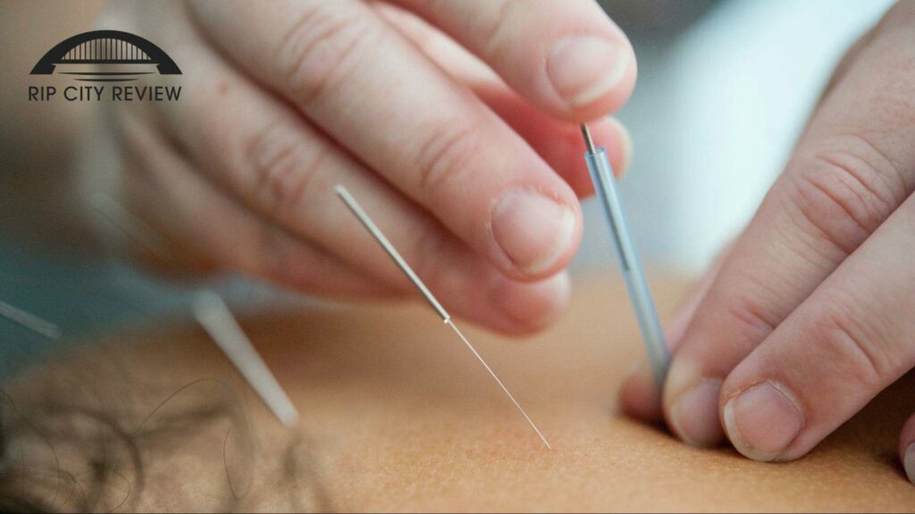 The Best Acupuncture Services in Portland